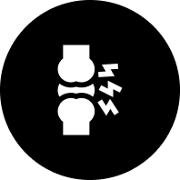 Arthritis