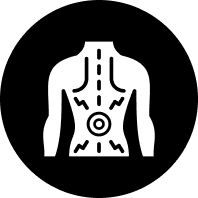 Sciatica